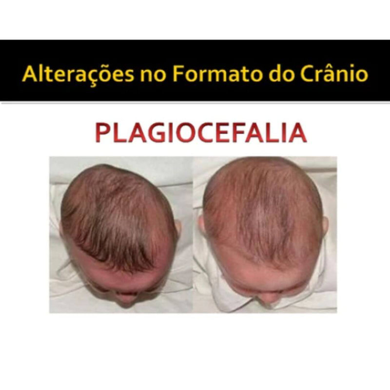 Ninho para Berço Anti Plagiocefalia